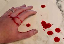 Bleeding taken by Gianna Goldfarb for Ode to My Mistakes by anonymous